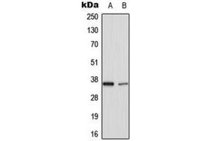 Western blot analysis of TNFAIP1 expression in HuvEC (A), rat lung (B) whole cell lysates.