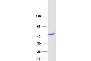 Validation with Western Blot