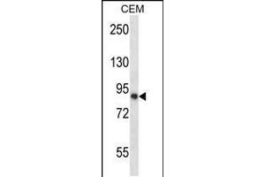 Western blot analysis in CEM cell line lysates (35ug/lane). (CAPN11 anticorps  (AA 409-438))