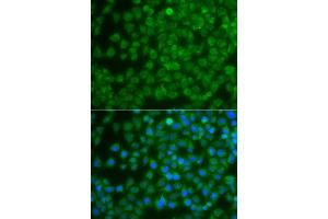 Immunofluorescence analysis of A549 cell using SPIB antibody. (SPIB anticorps)