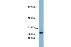 WB Suggested Anti-SPRR3 Antibody Titration:  0. (SPRR3 anticorps  (Middle Region))