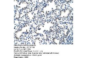 Rabbit Anti-HNRPLL Antibody  Paraffin Embedded Tissue: Human Lung Cellular Data: Alveolar cells Antibody Concentration: 4. (HNRPLL anticorps  (N-Term))