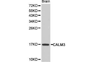 Western blot analysis of extracts of mouse brain, using CALM3 antibody (ABIN5970507).