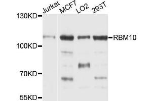 Western blot analysis of extracts of various cell lines, using RBM10 antibody (ABIN5972338) at 1/1000 dilution.