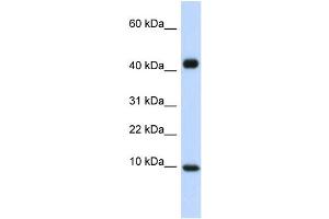 WB Suggested Anti-CCL8 Antibody Titration:  0. (CCL8 anticorps  (Middle Region))