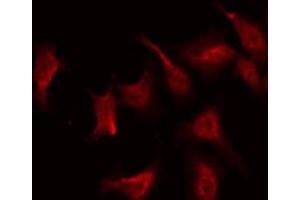 ABIN6268864 staining NIH-3T3 by IF/ICC.