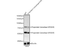 Western blot analysis of extracts of HeLa cells, using Proprotein Convertase 9(PCSK9) antibody  at 1:1000 dilution.