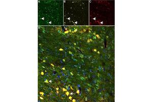 Apamin toxin binding sites co-localize with SK1, and SK2 ion channels in mouse Thalamus.