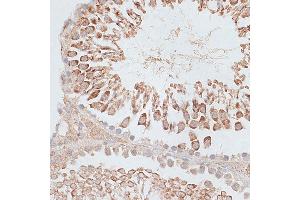 Immunohistochemistry of paraffin-embedded Rat testis using KIF2C/MCAK antibody (ABIN6128155, ABIN6142869, ABIN6142870 and ABIN6221103) at dilution of 1:100 (40x lens). (KIF2C anticorps  (AA 1-190))