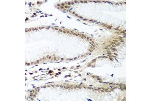 Immunohistochemistry of paraffin-embedded human stomach using PTTG1 antibody at dilution of 1:100 (40x lens).