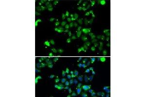 Immunofluorescence analysis of A-549 cells using U2AF1L4 Polyclonal Antibody (Splicing factor U2AF 26 kDa subunit (U2AF1L4) anticorps)