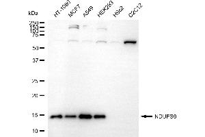 Western blotting analysis using NDUFS6 antibody (ABIN7799558).
