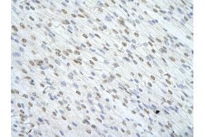 Rabbit Anti-SF1 antibody   Paraffin Embedded Tissue: Human Heart cell Cellular Data: cardiac cell of renal tubule Antibody Concentration: 4.