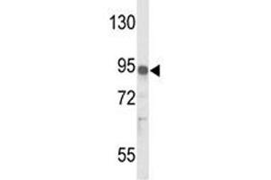 Western blot analysis of IL17RD antibody and MDA-MB231 lysate. (IL17RD anticorps  (AA 217-245))