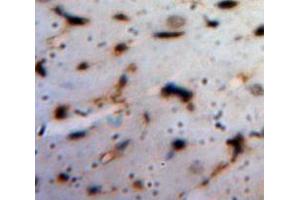 IHC-P analysis of Heart tissue, with DAB staining. (ANGPTL1 anticorps  (AA 271-491))