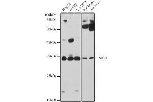 Western blot analysis of extracts of various cell lines, using MGLL antibody (ABIN6128306, ABIN6143823, ABIN6143824 and ABIN6222352) at 1:1000 dilution. (MGLL anticorps  (AA 1-303))