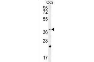 Western Blotting (WB) image for anti-F-Box and WD Repeat Domain Containing 12 (FBXW12) antibody (ABIN2995589)