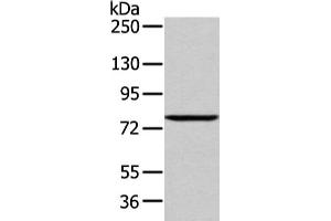 Gel: 6 % SDS-PAGE, Lysate: 60 μg, Lane: 293T cell, Primary antibody: ABIN7193043(WDR91 Antibody) at dilution 1/400 dilution, Secondary antibody: Goat anti rabbit IgG at 1/8000 dilution, Exposure time: 1 minute (WDR91 anticorps)
