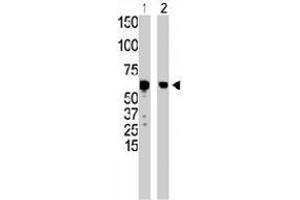The GCK polyclonal antibody  is used in Western blot to detect GCK in HepG2 cell lysate (Lane 1) and mouse liver tissue lysate (Lane 2) . (GCK anticorps  (N-Term))