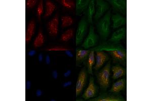 ABIN6258139 and ABIN6275929 staining  cells by IF/ICC.