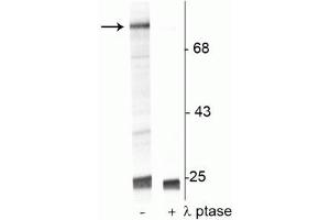 Western blot of UV treated human Jurkat cell lysate showing specific immunolabeling of the ~74 kDa Raf-1 protein phosphorylated at Ser301 in the first lane (-). (RAF1 anticorps  (pSer301))