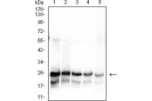 Western blot analysis using SARS-Cov2-NP1 mAb against human SARS-Cov2-N (AA: 1-180) recombinant protein. (SARS-Cov2-NP1 (AA 1-180) anticorps)