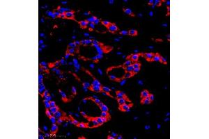 Immunofluorescence (IF) image for anti-Chloride Intracellular Channel 6 (CLIC6) antibody (ABIN7073478)