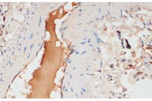 Immunohistochemistry of paraffin-embedded Human lung using APOC1 Polyclonal Antibody at dilution of 1:100 (40x lens). (APOC1 anticorps)