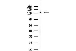 Western blot analysis of lysates from Rat testis, using MTHFL Antibody at 1/1000 dilution.