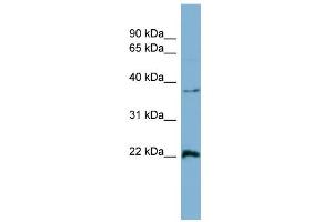 WB Suggested Anti-RAN Antibody Titration: 0. (RAN anticorps  (Middle Region))