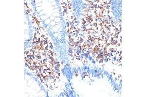 Immunohistochemistry of paraffin-embedded human appendix using ELMO1 Rabbit mAb (ABIN7266951) at dilution of 1:100 (40x lens). (ELMO1 anticorps)