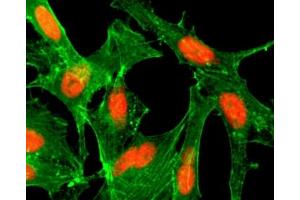 ICC/IF staining of HeLa cells treated with sodium butyrate using recombinant H4K12ac antibody (red). (Recombinant Histone H4 anticorps  (acLys12))