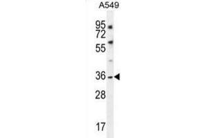 Western Blotting (WB) image for anti-Potassium Channel Subfamily K Member 1 (KCNK1) antibody (ABIN2996574) (KCNK1 anticorps)