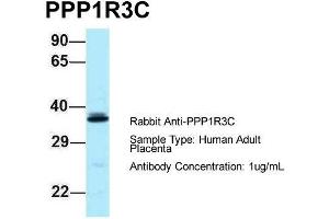 Host: Rabbit  Target Name: PPP1R3C  Sample Tissue: Human Adult Placenta  Antibody Dilution: 1. (PPP1R3C anticorps  (N-Term))