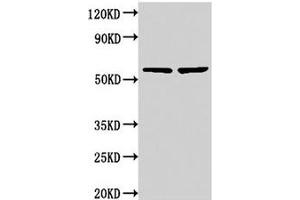 Western Blot Positive WB detected in: 293 whole cell lysate, 293T whole cell lysate All lanes: NOP58 antibody at 3.