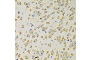 Immunohistochemistry of paraffin-embedded mouse brain using ADSS antibody. (ADSS anticorps)