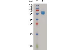 Human T Protein, hFc Tag on SDS-PAGE under reducing condition.