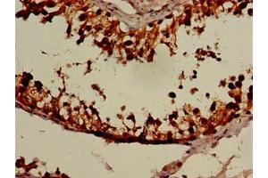 Immunohistochemistry of paraffin-embedded human testis tissue using ABIN7161039 at dilution of 1:100 (NANOS3 anticorps  (AA 21-192))