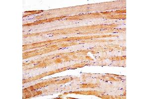 anti-Presenilin 2 (Alzheimer Disease 4) (PSEN2) (C-Term) antibody