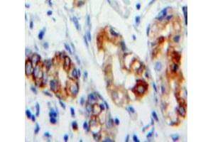 Used in DAB staining on fromalin fixed paraffin-embedded Stomach tissue (CD36 anticorps  (AA 187-428))
