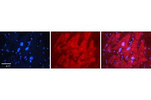 Rabbit Anti-MBNL1 Antibody   Formalin Fixed Paraffin Embedded Tissue: Human heart Tissue Observed Staining: Cytoplasmic, nucleus Primary Antibody Concentration: 1:100 Other Working Concentrations: N/A Secondary Antibody: Donkey anti-Rabbit-Cy3 Secondary Antibody Concentration: 1:200 Magnification: 20X Exposure Time: 0. (MBNL1 anticorps  (C-Term))
