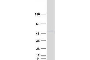 Validation with Western Blot