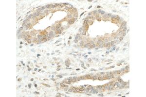 Immunohistochemistry (IHC) image for anti-Ribosomal Protein S5 (RPS5) (AA 1-50) antibody (ABIN7455001) (RPS5 anticorps  (AA 1-50))