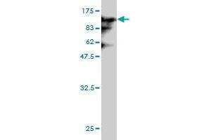 Fc-H5 Recombinant protein( 1&microg/mL) (75 KDa) . (Hemagglutinin anticorps  (AA 17-531))