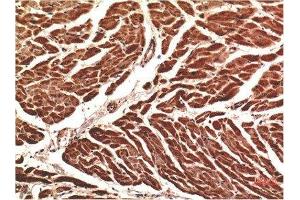 Immunohistochemical analysis of paraffin-embedded Human Heart Tissue using VE-Cadherin Mouse mAb diluted at 1:200. (Cadherin 5 anticorps  (AA 670-750))