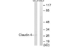 Immunohistochemistry analysis of paraffin-embedded human brain tissue, using Claudin 4 (Ab-208) antibody.