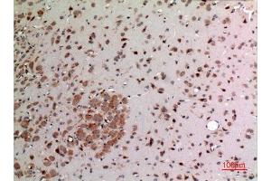 Immunohistochemistry (IHC) analysis of paraffin-embedded Rat Brain, antibody was diluted at 1:100.