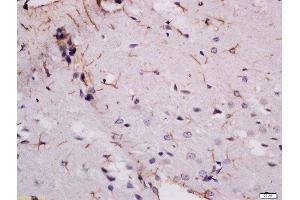 Formalin-fixed and paraffin embedded rat brain labeled with Rabbit Anti-MDGA2 Polyclonal Antibody, Unconjugated  at 1:200 followed by conjugation to the secondary antibody and DAB staining (MDGA2 anticorps  (AA 751-850))