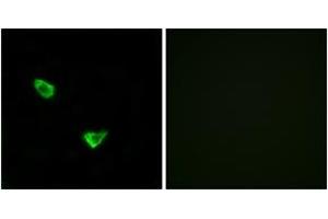 Immunofluorescence analysis of MCF7 cells, using CHSY2 Antibody. (CHPF anticorps  (AA 631-680))