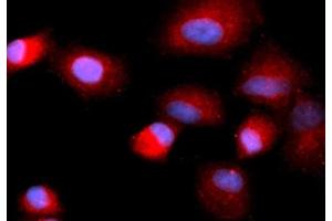 Immunofluorescence (IF) image for anti-Cofilin 1 (CFL1) (AA 1-166) antibody (APC) (ABIN5566999) (Cofilin anticorps  (AA 1-166) (APC))